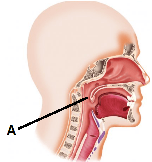 Question Image