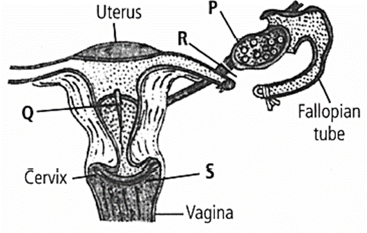 Question Image