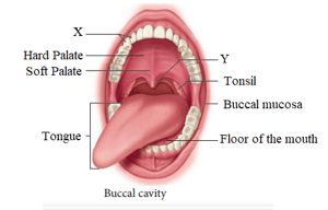 Question Image